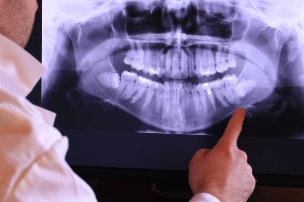 Emergency Gum Pain Relief in NY
